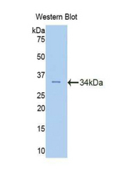 Western blot of recombinant FSCN2 / Retinal Fascin.