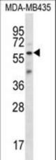 FSCN3 Antibody western blot of MDA-MB435 cell line lysates (35 ug/lane). The FSCN3 antibody detected the FSCN3 protein (arrow).