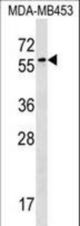 FSD1 Antibody western blot of MDA-MB453 cell line lysates (35 ug/lane). The FSD1 antibody detected the FSD1 protein (arrow).