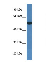 FSD1L antibody LS-C135825 Western blot of 1 Cell lysate. Antibody concentration 1 ug/ml.