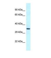 Western blot of Human COLO205. FSD1L antibody dilution 1.0 ug/ml.