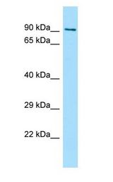 FSD2 antibody Western Blot of 721_B.