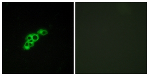 Immunofluorescence of MCF7 cells, using FSHR Antibody. The picture on the right is treated with the synthesized peptide.