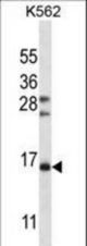 FSHB/FSH Antibody western blot of K562 cell line lysates (35 ug/lane). The FSHB/FSH antibody detected the FSHB/FSH protein (arrow).