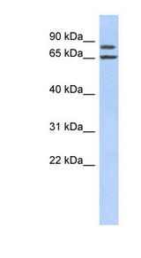 FSIP1 antibody LS-C102510 Western blot of Jurkat lysate.