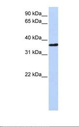Fetal heart lysate. Antibody concentration: 1.0 ug/ml. Gel concentration: 12%.