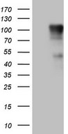 HEK293T cells were transfected with the pCMV6-ENTRY control (Left lane) or pCMV6-ENTRY FSIP1 (Right lane) cDNA for 48 hrs and lysed. Equivalent amounts of cell lysates (5 ug per lane) were separated by SDS-PAGE and immunoblotted with anti-FSIP1.