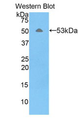 Western blot of recombinant FSIP1.
