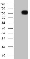 HEK293T cells were transfected with the pCMV6-ENTRY control (Left lane) or pCMV6-ENTRY FSIP1 (Right lane) cDNA for 48 hrs and lysed. Equivalent amounts of cell lysates (5 ug per lane) were separated by SDS-PAGE and immunoblotted with anti-FSIP1.