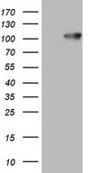 HEK293T cells were transfected with the pCMV6-ENTRY control (Left lane) or pCMV6-ENTRY FSIP1 (Right lane) cDNA for 48 hrs and lysed. Equivalent amounts of cell lysates (5 ug per lane) were separated by SDS-PAGE and immunoblotted with anti-FSIP1.