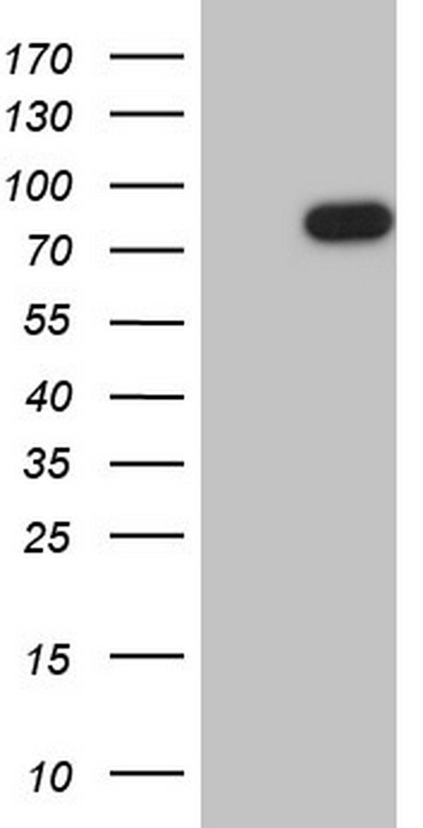 HEK293T cells were transfected with the pCMV6-ENTRY control (Left lane) or pCMV6-ENTRY FSIP1 (Right lane) cDNA for 48 hrs and lysed. Equivalent amounts of cell lysates (5 ug per lane) were separated by SDS-PAGE and immunoblotted with anti-FSIP1.