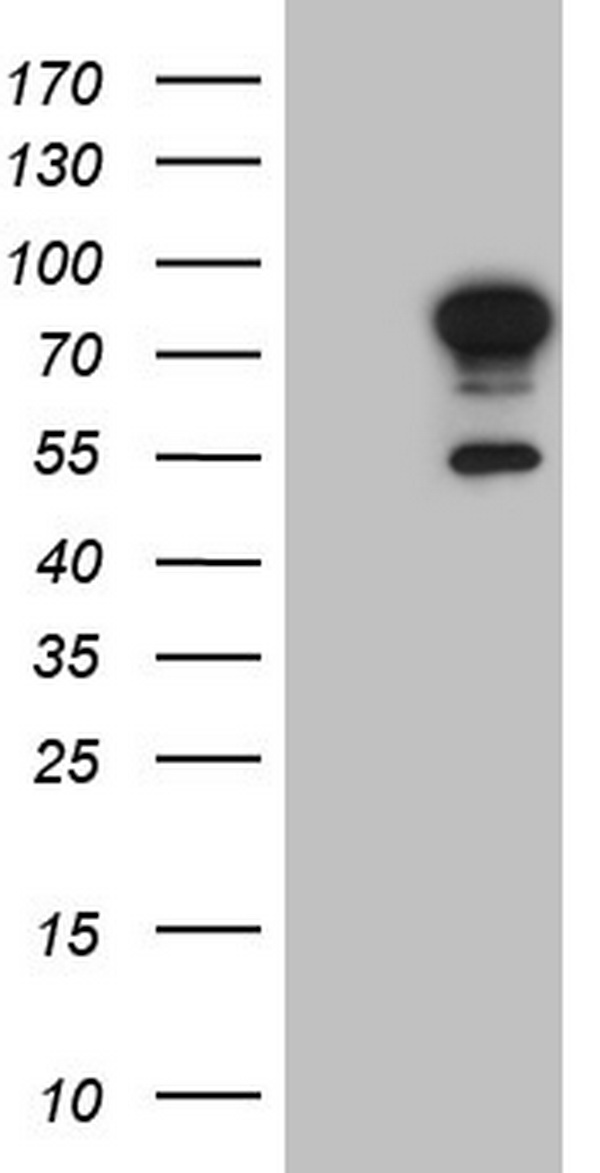 HEK293T cells were transfected with the pCMV6-ENTRY control (Left lane) or pCMV6-ENTRY FSIP1 (Right lane) cDNA for 48 hrs and lysed. Equivalent amounts of cell lysates (5 ug per lane) were separated by SDS-PAGE and immunoblotted with anti-FSIP1.
