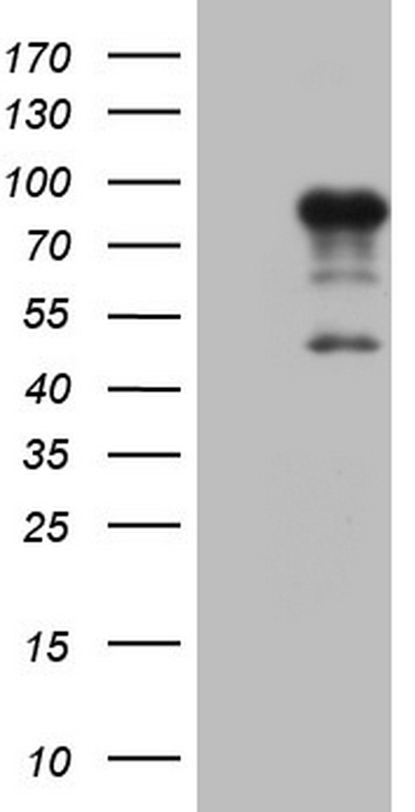 HEK293T cells were transfected with the pCMV6-ENTRY control (Left lane) or pCMV6-ENTRY FSIP1 (Right lane) cDNA for 48 hrs and lysed. Equivalent amounts of cell lysates (5 ug per lane) were separated by SDS-PAGE and immunoblotted with anti-FSIP1.
