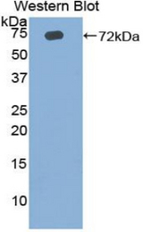 Western blot of recombinant FSP27 / CIDEC.