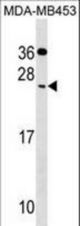 CIDEC Antibody western blot of MDA-MB453 cell line lysates (35 ug/lane). The CIDEC antibody detected the CIDEC protein (arrow).