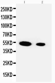 WB of FSTL3 / FLRG antibody. Recombinant Protein Detection Source:. E.coli derived -recombinant Human FSTL3, 39.2KD. (162aa tag+ L52-P251). Lane 1: Recombinant Human FSTL3 Protein 10ng. Lane 2: Recombinant Human FSTL3 Protein 5ng.
