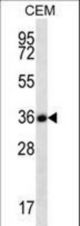 FSTL3 Antibody western blot of CEM cell line lysates (35 ug/lane). The FSTL3 antibody detected the FSTL3 protein (arrow).