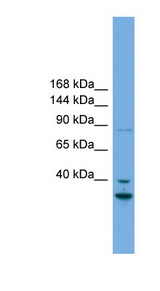 FSTL5 antibody LS-C112038 Western blot of Fetal Heart lysate.
