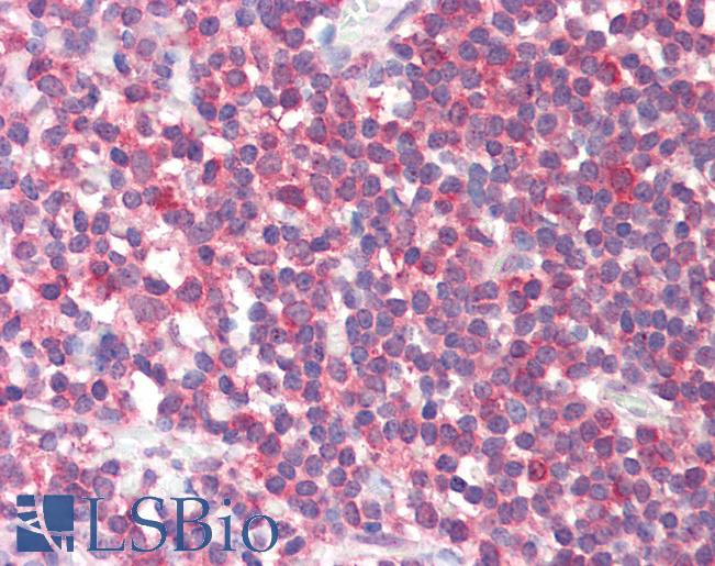 Anti-FTHFSDC1 / MTHFD1L antibody IHC staining of human tonsil. Immunohistochemistry of formalin-fixed, paraffin-embedded tissue after heat-induced antigen retrieval. Antibody LS-B9540 concentration 5 ug/ml.