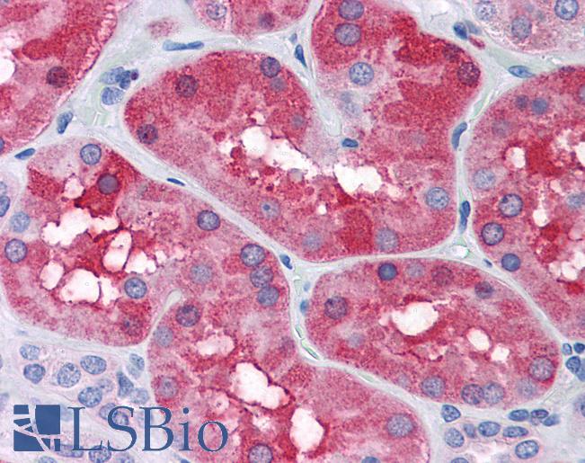 Anti-FTL antibody IHC of human kidney. Immunohistochemistry of formalin-fixed, paraffin-embedded tissue after heat-induced antigen retrieval. Antibody LS-B4383 concentration 3.75 ug/ml.