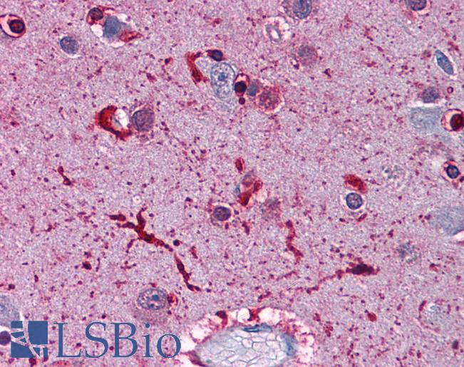 Anti-FTL antibody IHC of human brain, cortex. Immunohistochemistry of formalin-fixed, paraffin-embedded tissue after heat-induced antigen retrieval. Antibody LS-B4383 concentration 3.75 ug/ml.