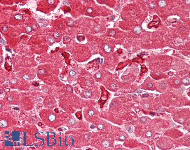 Anti-FTL / Ferritin Light Chain antibody IHC of human liver. Immunohistochemistry of formalin-fixed, paraffin-embedded tissue after heat-induced antigen retrieval. Antibody LS-B8218 dilution 5-7.5 ug/ml.