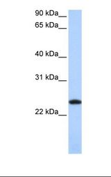 HepG2 cell lysate. Antibody concentration: 1.0 ug/ml. Gel concentration: 12%.
