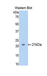 Western blot of recombinant FTMT / MTF.