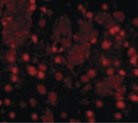 Immunofluorescence of FTO in Mouse Brain cells with FTO antibody at 20 ug/ml.