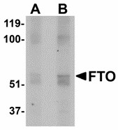 Western blot of FTO in human uterus tissue lysate with FTO antibody at (A) 1 and (B) 2 ug/ml. Below: Immunohistochemistry of FTO in mouse brain tissue with FTO antibody at 2.5 ug/ml.