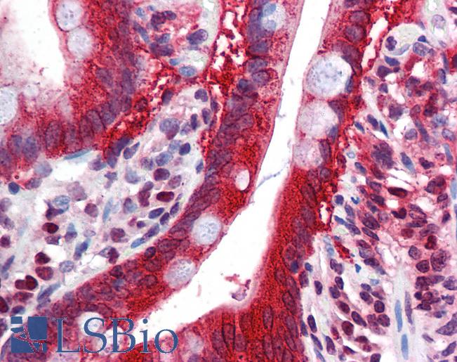 Anti-FTO antibody IHC of human small intestine. Immunohistochemistry of formalin-fixed, paraffin-embedded tissue after heat-induced antigen retrieval. Antibody LS-B5891 concentration 5 ug/ml.