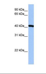 HepG2 cell lysate. Antibody concentration: 1.0 ug/ml. Gel concentration: 12%.