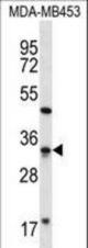 FTSJ1 Antibody western blot of MDA-MB453 cell line lysates (35 ug/lane). The FTSJ1 antibody detected the FTSJ1 protein (arrow).