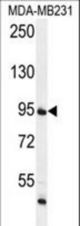 FTSJ3 Antibody western blot of MDA-MB231 cell line lysates (35 ug/lane). The FTSJ3 antibody detected the FTSJ3 protein (arrow).