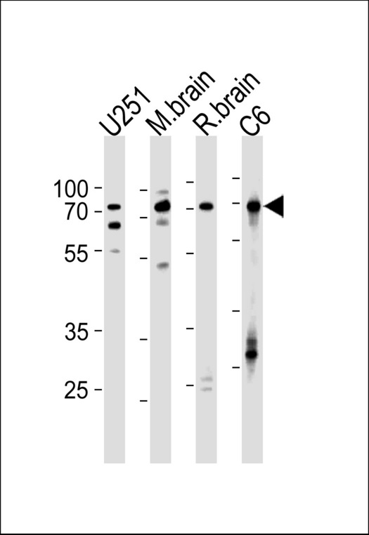 FUBP1 Antibody western blot of U251,rat C6 cell line,mouse brain,rat brain tissue lysates (35 ug/lane). The FUBP1 antibody detected the FUBP1 protein (arrow).