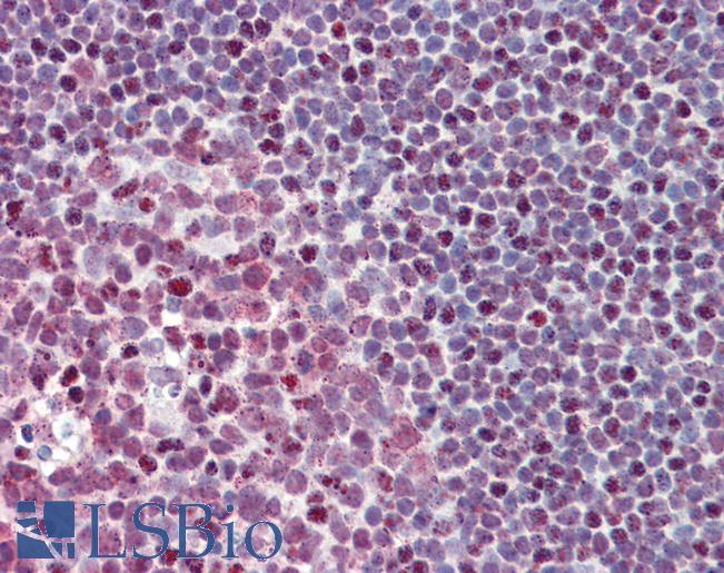 Anti-FUBP1 antibody IHC staining of human tonsil. Immunohistochemistry of formalin-fixed, paraffin-embedded tissue after heat-induced antigen retrieval. Antibody LS-B9559 concentration 5 ug/ml.