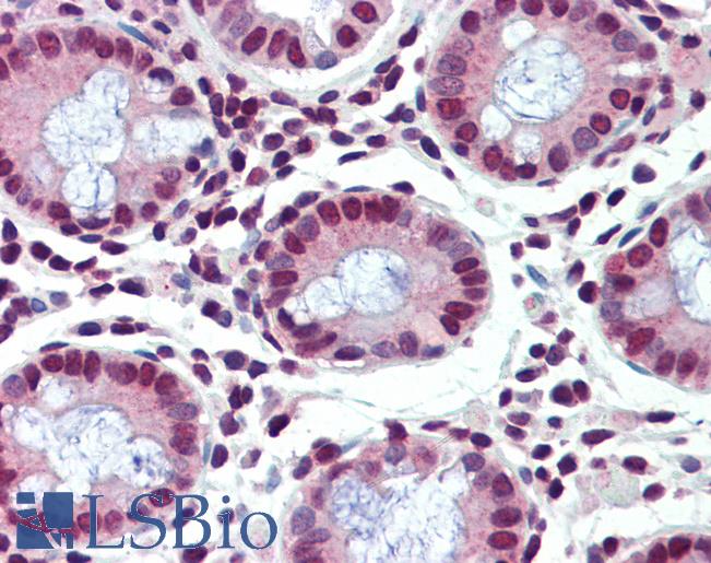 Anti-FUBP1 antibody IHC of human colon. Immunohistochemistry of formalin-fixed, paraffin-embedded tissue after heat-induced antigen retrieval. Antibody LS-B3513 concentration 5 ug/ml.