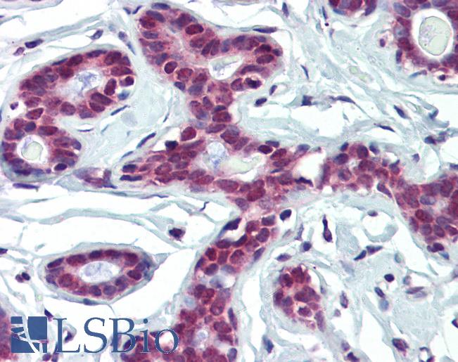 Anti-FUBP1 antibody IHC of human breast. Immunohistochemistry of formalin-fixed, paraffin-embedded tissue after heat-induced antigen retrieval. Antibody LS-B3513 concentration 5 ug/ml.