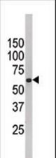 Western blot of anti-FUBP3 antibody in HepG2 cell line lysate (35 ug/lane). FUBP3(arrow) was detected using the purified antibody.