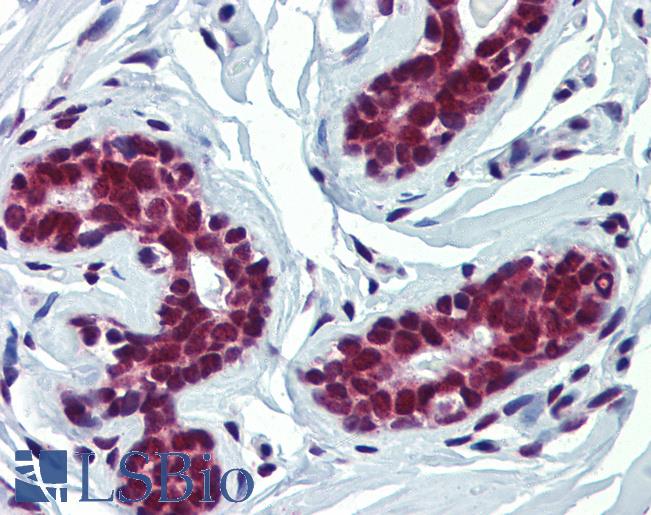 Anti-FUBP3 / FBP3 antibody IHC of human breast. Immunohistochemistry of formalin-fixed, paraffin-embedded tissue after heat-induced antigen retrieval. Antibody LS-B4018 concentration 5 ug/ml.