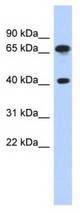 Western analysis of THP-1 cell lysate.