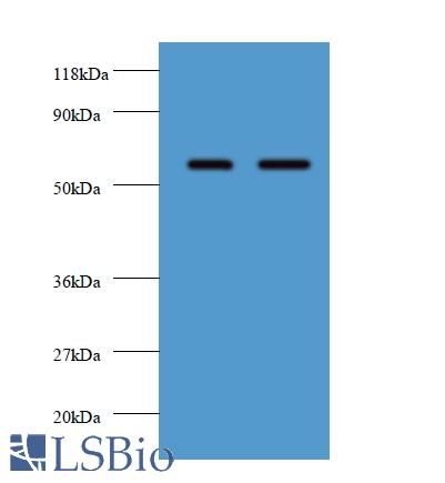 Western blot of Plasma alpha-L-fucosidase antibody at 2 ug/ml. Lane 1: EC109 whole cell lysate. Lane 2: 293T whole cell lysate. Secondary: Goat polyclonal to rabbit IgG at 1:10000 dilution. Predicted band size: 51 kDa. Observed band size: 51 kDa.