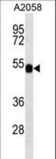 FUCA2 western blot of A2058 cell line lysates (35 ug/lane). The FUCA2 antibody detected the FUCA2 protein (arrow).
