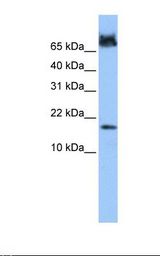 Fetal heart cell lysate. Antibody concentration: 1.0 ug/ml. Gel concentration: 10%-20%.