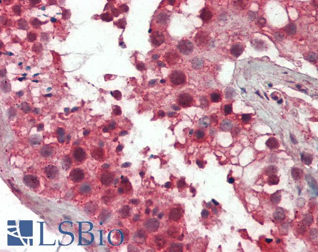 Human Testis: Formalin-Fixed, Paraffin-Embedded (FFPE)