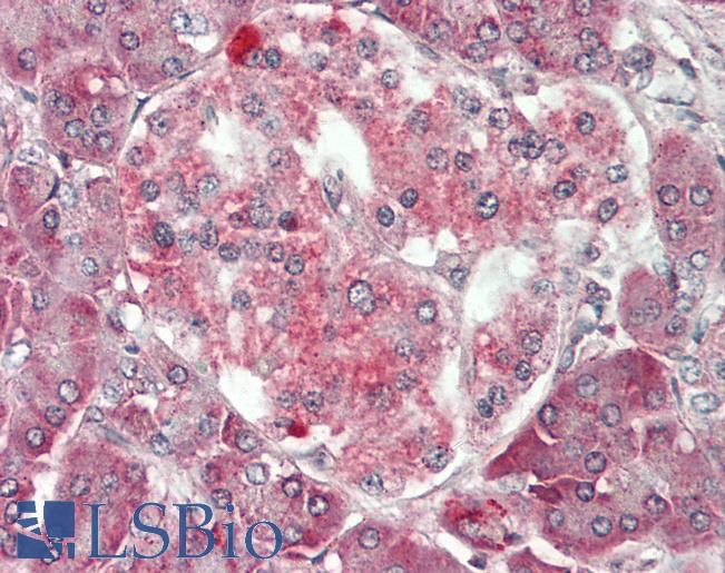 Human Pancreas: Formalin-Fixed, Paraffin-Embedded (FFPE)