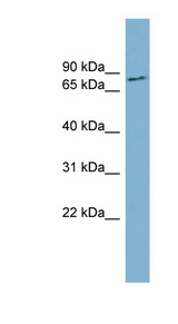 FURIN antibody LS-C111020 Western blot of THP-1 cell lysate.