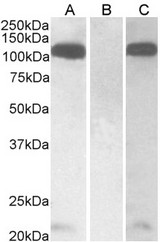 FURIN antibody HEK293 lysate (10 ug protein in RIPA buffer) overexpressing Human Furin with C-terminal MYC tag probed with (0.01 ug/ml) in Lane A and probed with anti-MYC Tag (1/1000) in lane C. Mock-transfected HEK293 probed with (0.01 mg/ml) in Lane B. Primary incubations were for 1 hour. Detected by chemiluminescence.