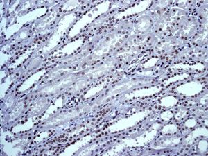 IHC of paraffin-embedded human kidney tissue using anti-FUS antibody.