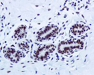 IHC of paraffin-embedded human breast tissue using anti-FUS antibody.